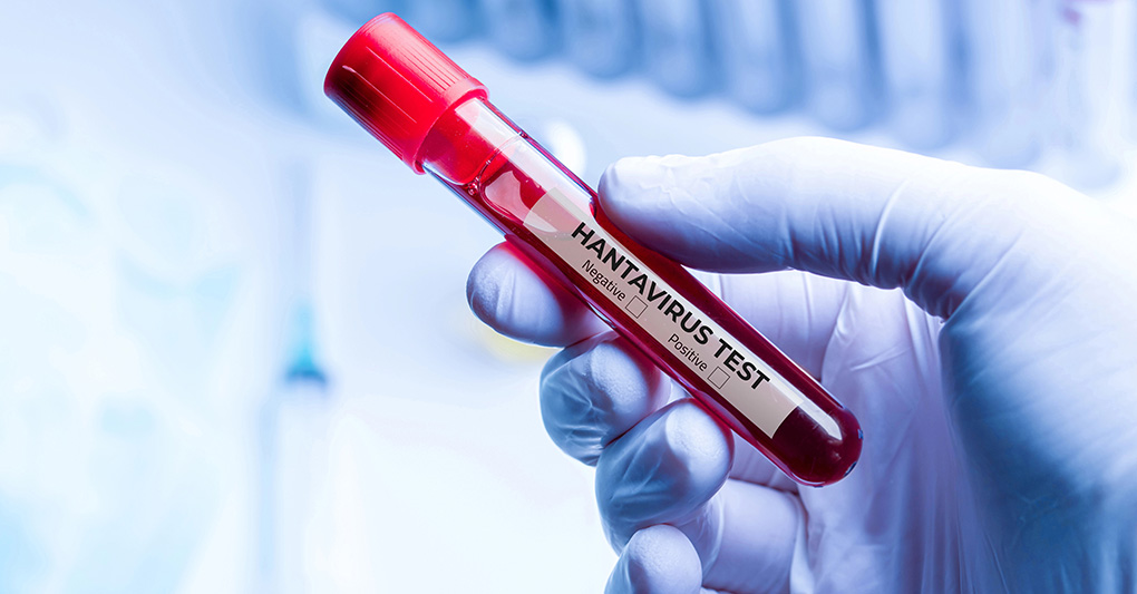 Hantavirus: l’America no vax non ha imparato la lezione - Garlasco: dentro il reality show