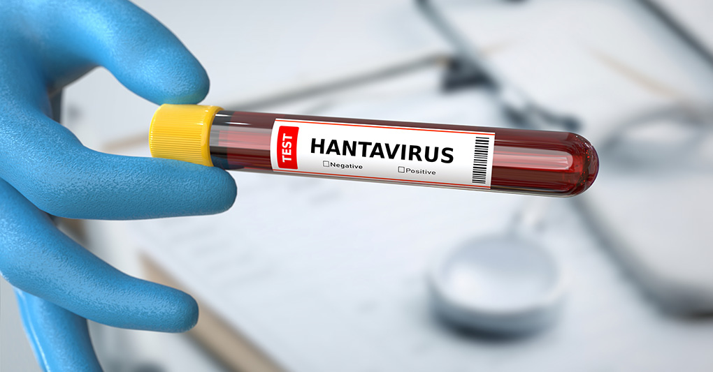 Hantavirus: tranquilli o in allerta? episode artwork