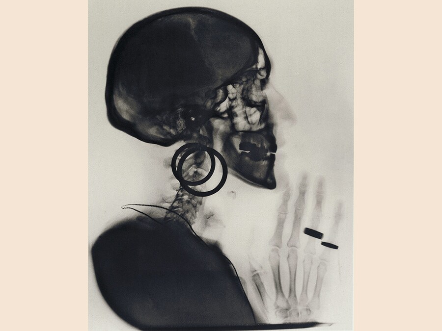Meret Oppenheim, Sketch for X-ray of Meret Oppenheim's Skull, 1978, cm 34,5 x 27,5, courtesy Levy Galerie, Hamburg, © Meret Oppenheim by Siae 2019