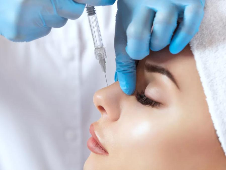 Rinofiller, un trattamento molto richiesto, indicato per trattare piccole malformazioni come una punta che scende o il dorso del naso leggermente incavato o un leggero gibbo
