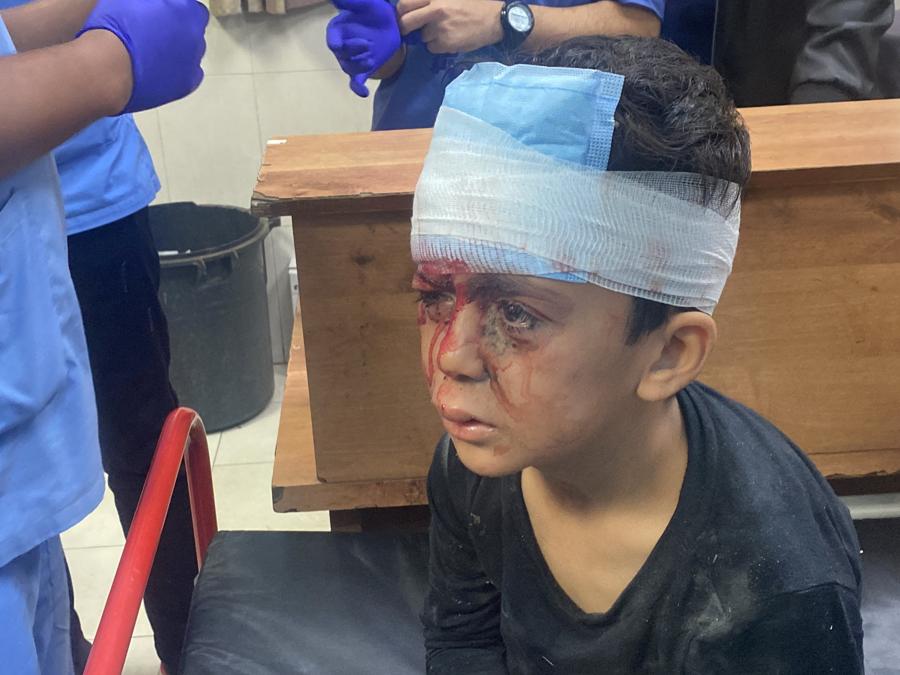 Un ragazzo palestinese ferito in un attacco israeliano viene assistito, dopo la scadenza di una tregua temporanea tra Hamas e Israele, all’ospedale Nasser di Khan Younis, nel sud della Striscia di Gaza. REUTERS/Arafat Barbakh