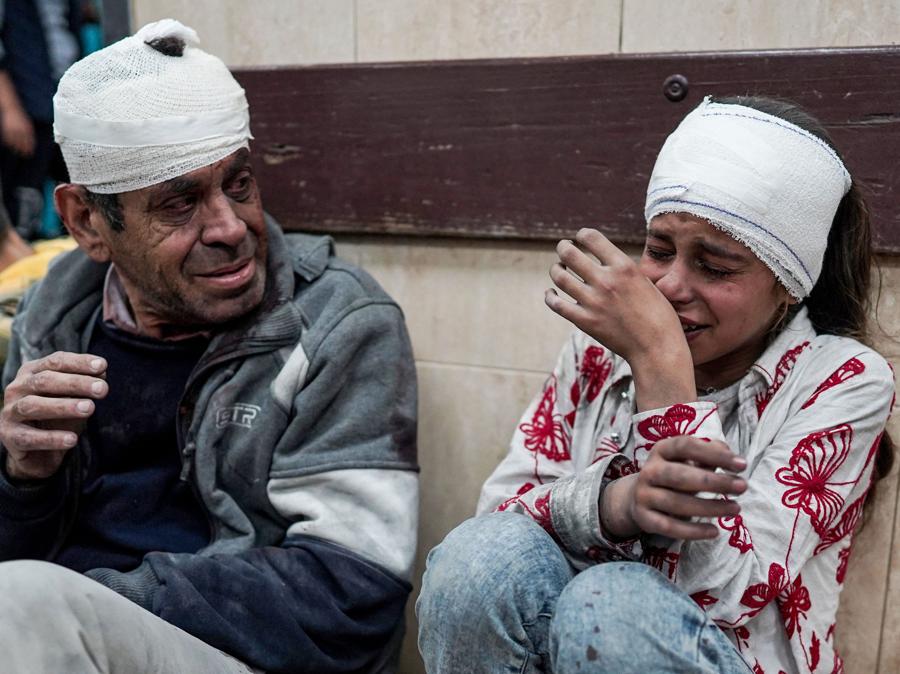 Palestinesi feriti durante il bombardamento israeliano sul campo profughi di Nuseirat nel centro di Gaza, aspettano di ricevere cure mediche presso l’ospedale dei martiri di al-Aqsa a Deir el-Balah a Gaza. (Photo by AFP)