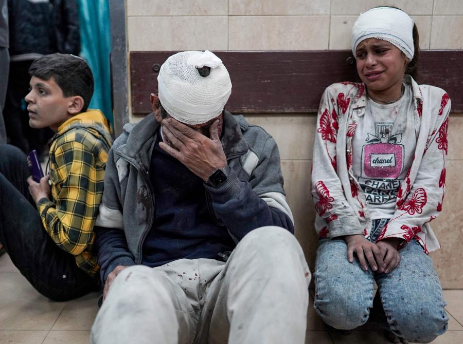 Palestinesi feriti durante il bombardamento israeliano sul campo profughi di Nuseirat nel centro di Gaza, aspettano di ricevere cure mediche presso l’ospedale dei martiri di al-Aqsa a Deir el-Balah a Gaza. (Photo by AFP)