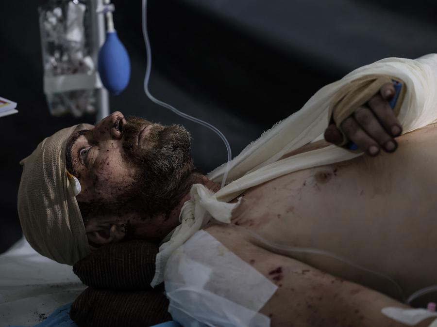 Un militare ferito che riceve cure mediche da medici da combattimento della 24a brigata meccanizzata in prima linea vicino a Chasiv Yar , regione di Donetsk. (Photo by Handout / press service of the 24th mechanized brigade of Ukrainian Armed forces / AFP) 