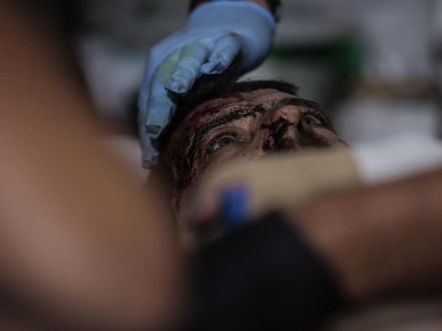 Un militare ferito che riceve cure mediche da medici da combattimento della 24a brigata meccanizzata in prima linea vicino a Chasiv Yar , regione di Donetsk. (Photo by Handout / press service of the 24th mechanized brigade of Ukrainian Armed forces / AFP) 