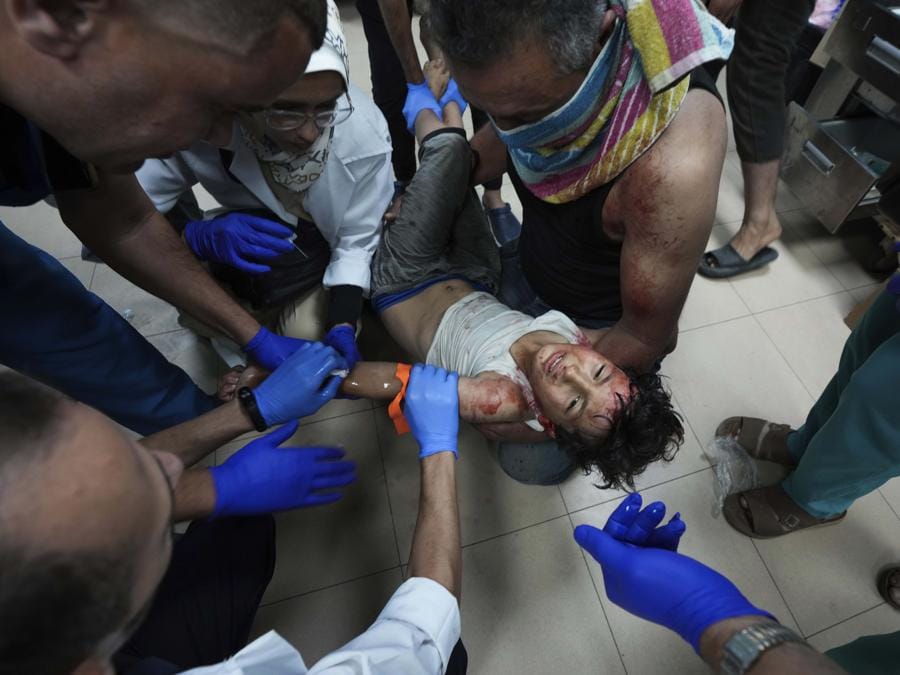 Un bambino palestinese ferito nel bombardamento israeliano della Striscia di Gaza viene curato in un ospedale di Deir al-Balah. (AP Photo/Abdel Kareem Hana) Associated Press/LaPresse