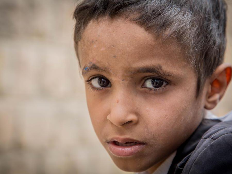 Ismail, Yemen. Credit: Mohammed Awadh / Save the Children