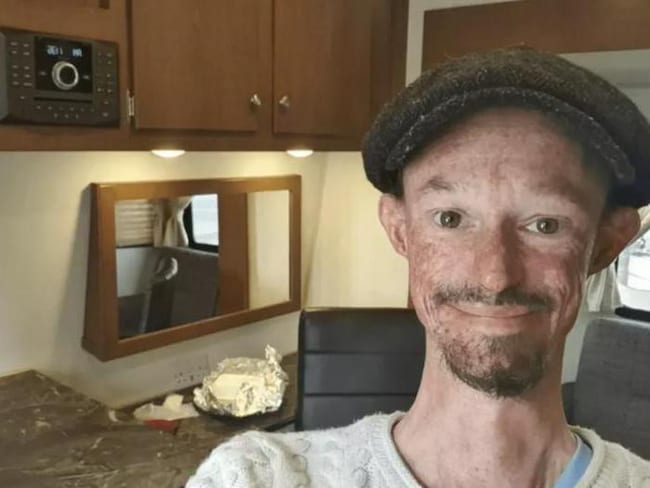 È morto Darren Kent, attore di “Il trono di spade”. Aveva 36 anni