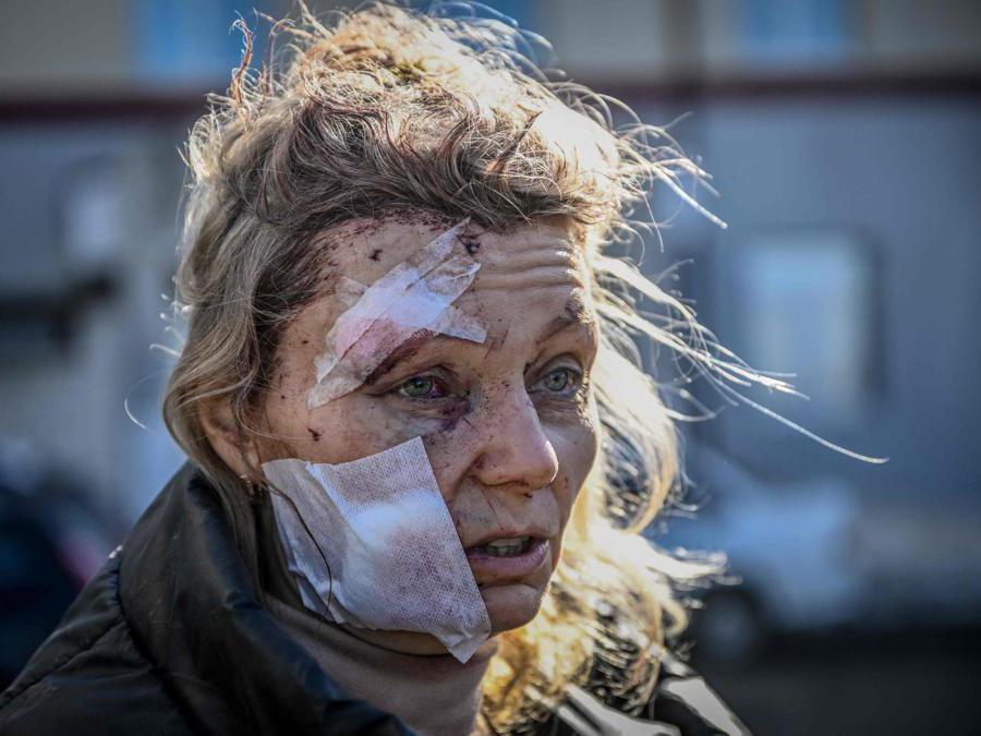 (Photo by Aris Messinis / AFP)